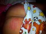 My spanked bottom in my Crinklz diaper